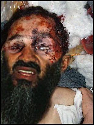 Autopsy photos of Bin Laden showing post mortem markings from various "stress postion" interrogation techniques
